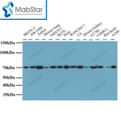 YY1 Monoclonal Antibody