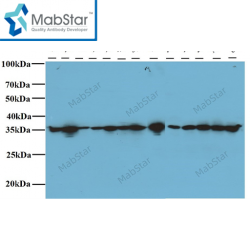 VDAC1/Porin Monoclonal Antibody