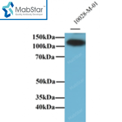 ATP1A1 Monoclonal Antibody