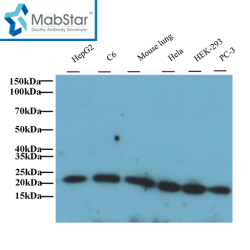 KRAS Polyclonal Antibody