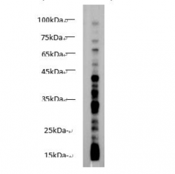 Butyryl Lysine Rabbit Polyclonal Antibody